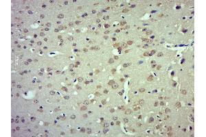 Paraformaldehyde-fixed, paraffin embedded mouse brain; Antigen retrieval by boiling in sodium citrate buffer (pH6. (TRPM4 antibody  (AA 800-850))