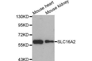 Western blot analysis of extracts of various cell lines, using SLC16A2 antibody. (SLC16A2/MCT8 antibody  (AA 1-100))