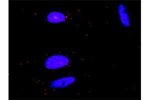 Proximity Ligation Analysis of protein-protein interactions between GRAP2 and CSF1R. (CSF1R antibody  (AA 21-120))