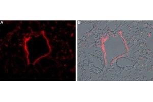 Expression of TRPM2 in rat lung - Immunohistochemical staining of rat lung frozen sections using Anti-TRPM2-ATTO Fluor-594 Antibody (ABIN7043830), (1:50). (TRPM2 antibody  (Intracellular, N-Term) (Atto 594))