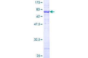 ASS1 Protein (AA 1-412) (GST tag)