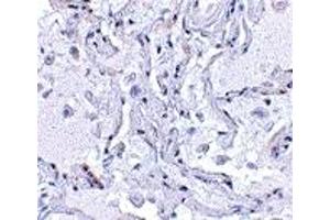 Immunohistochemistry (IHC) image for anti-Transition Protein 1 (During Histone To Protamine Replacement) (TNP1) (N-Term) antibody (ABIN1031638) (TNP1 antibody  (N-Term))