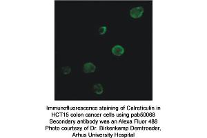Image no. 1 for anti-Calreticulin (CALR) antibody (ABIN363377) (Calreticulin antibody)