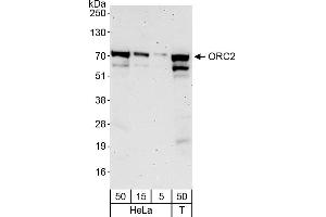 Western Blotting (WB) image for anti-Origin Recognition Complex Subunit 2 (ORC2) (AA 150-200) antibody (ABIN7453749)
