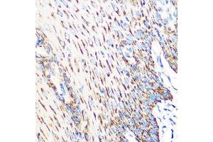 Immunohistochemistry (IHC) image for anti-Odd-Skipped Related 1 (OSR1) antibody (ABIN7269080)
