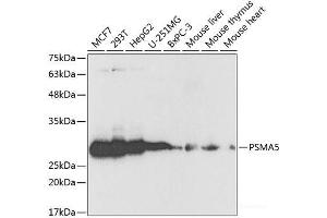 Western blot analysis of extracts of various cell lines using PSMA5 Polyclonal Antibody at dilution of 1:1000.