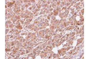 IHC-P Image Immunohistochemical analysis of paraffin-embedded SAS xenograft, using G protein alpha Inhibitor 3, antibody at 1:500 dilution. (G Protein alpha Inhibitor 3 (Center) antibody)