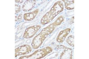 Immunohistochemistry of paraffin-embedded rat kidney using [KO Validated] NDUFB4 Rabbit pAb (ABIN6133349, ABIN6144476, ABIN6144477 and ABIN7101430) at dilution of 1:150 (40x lens). (NDUFB4 antibody  (AA 1-90))