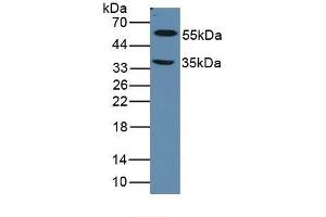 Detection of LOXL1 in Mouse Eye Tissue using Polyclonal Antibody to Lysyl Oxidase Like Protein 1 (LOXL1) (LOXL1 antibody  (AA 392-598))