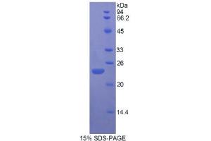 SDS-PAGE (SDS) image for Fibroblast Growth Factor 13 (FGF13) (AA 1-192) protein (His tag) (ABIN2121049) (FGF13 Protein (AA 1-192) (His tag))