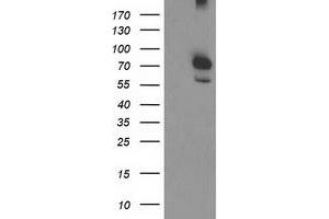HEK293T cells were transfected with the pCMV6-ENTRY control (Left lane) or pCMV6-ENTRY CAPN9 (Right lane) cDNA for 48 hrs and lysed. (Calpain 9 antibody)