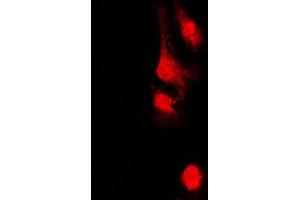 Immunofluorescent analysis of AKAP13 staining in HeLa cells. (AKAP13 antibody  (Center))