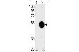 Western blot analysis of DOK2 (arrow) using DOK2 Antibody (C-term) (ABIN392072 and ABIN2841834). (DOK2 antibody  (C-Term))