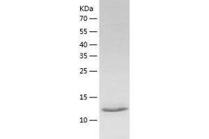 Western Blotting (WB) image for Bromodomain Adjacent To Zinc Finger Domain, 1B (BAZ1B) (AA 1335-1450) protein (His tag) (ABIN7122040) (BAZ1B Protein (AA 1335-1450) (His tag))