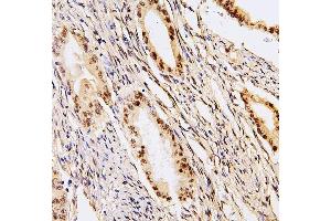 IHC analysis of PHF21A using anti-PHF21A antibody (ABIN6719353). (PHF21A antibody  (AA 1-97))