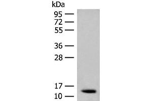Western blot analysis of Human fetal brain tissue lysate using AKAP7 Polyclonal Antibody at dilution of 1:200