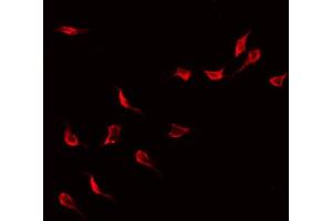 ABIN6268958 staining Hela by IF/ICC. (LCK antibody  (N-Term))