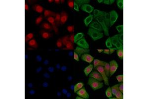 ABIN6266224 and ABIN6277495 staining Hela cells(heat shock treatment) by IF/ICC. (Histone 3 antibody  (H3K14me1))