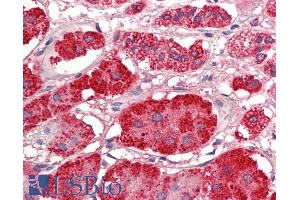 ABIN1781821 (5µg/ml) staining of paraffin embedded Human Adrenal Gland. (Acetyl-CoA Carboxylase beta antibody  (Internal Region))