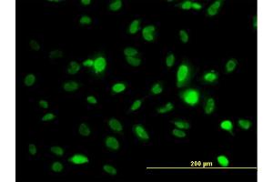 Immunofluorescence of monoclonal antibody to STK6 on HeLa cell. (Aurora A antibody  (AA 1-110))