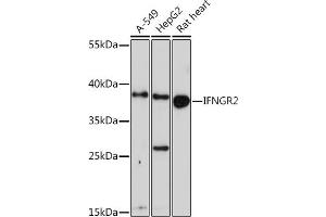 Western blot analysis of extracts of various cell lines, using IFNGR2 Rabbit pAb (ABIN6134791, ABIN6142199, ABIN6142201 and ABIN6218514) at 1:1000 dilution. (IFNGR2 antibody  (C-Term))