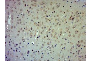 Immunohistochemistry (Paraffin-embedded Sections) (IHC (p)) image for anti-Metalloproteinase Inhibitor 2 (TIMP2) (AA 51-150) antibody (ABIN1713918)
