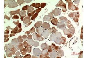 Immunohistochemistry (IHC) analysis of paraffin-embedded Human Muscle, antibody was diluted at 1:100. (MUTYH antibody  (pan))