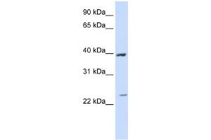 WB Suggested Anti-ACADL Antibody Titration:  0. (ACADL antibody  (Middle Region))