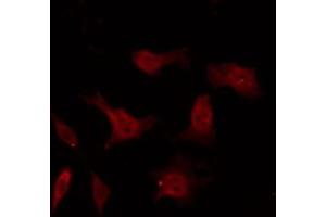 ABIN6267326 staining 293 by IF/ICC. (Tyrosine Hydroxylase antibody  (pSer40))