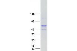 Western Blotting (WB) image for Nuclear Receptor Subfamily 2, Group E, Member 3 (NR2E3) (Transcript Variant 2) protein (Myc-DYKDDDDK Tag) (ABIN2727586)