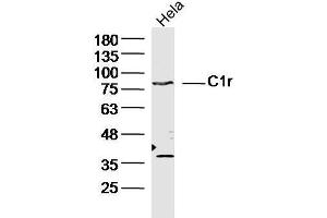 Human Hela cells probed with C1r Polyclonal Antibody, unconjugated  at 1:300 overnight at 4°C followed by a conjugated secondary antibody at 1:10000 for 90 minutes at 37°C. (C1R antibody  (AA 231-430))