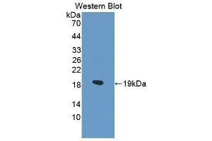 Western Blotting (WB) image for anti-Collagen, Type VI, alpha 1 (COL6A1) (AA 828-1022) antibody (ABIN1175577)
