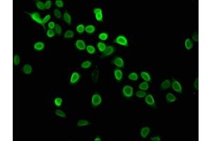 Immunofluorescence staining of Hela cells with ABIN7139604 at 1:2. (HIST1H4A antibody  (meLys5))