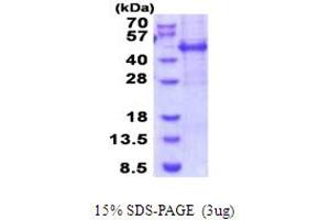 SDS-PAGE (SDS) image for Meis Homeobox 3 (MEIS3) (AA 1-358) protein (His tag) (ABIN5853959) (MEIS3 Protein (AA 1-358) (His tag))
