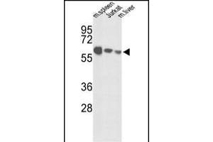Western blot analysis of IGFALS Antibody (Center) (ABIN391690 and ABIN2841595) in mouse spleen tissue, Jurkat cell line and mouse liver tissue lysates (35 μg/lane). (IGFALS antibody  (AA 308-335))