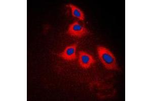 Immunofluorescent analysis of ARRDC3 staining in Jurkat cells. (ARRDC3 antibody  (C-Term))