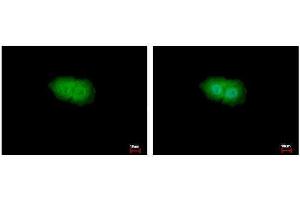 ICC/IF Image p90 RSK1 antibody detects p90 RSK1 protein at Cytoplasm and Nucleus by immunofluorescent analysis. (RPS6KA1 antibody  (Center))