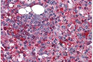 Human Spleen: Formalin-Fixed, Paraffin-Embedded (FFPE) (Anoctamin 2 antibody  (N-Term))