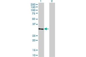 Western Blot analysis of ZNF397 expression in transfected 293T cell line by ZNF397 monoclonal antibody (M02), clone 1F8. (ZNF397 antibody  (AA 131-230))