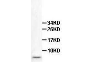 Western Blot analysis of fetal heart Lysate with anti-HOPX antibody at a dilution of 1/500. (HOPX antibody)