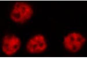 ABIN6269307 staining RAW264. (NFKB2 antibody  (C-Term))