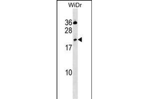 CLEC2D Antibody (Center) (ABIN1537750 and ABIN2850340) western blot analysis in WiDr cell line lysates (35 μg/lane). (CLEC2D antibody  (AA 109-137))