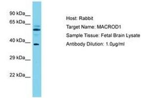 Image no. 1 for anti-MACRO Domain Containing 1 (MACROD1) (AA 83-132) antibody (ABIN6750601) (MACROD1 antibody  (AA 83-132))