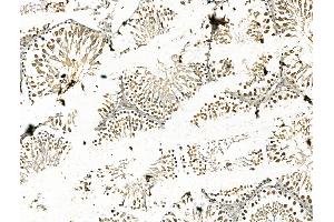 ABIN7094458 and ABIN7098506 at 1/100 staining Rat testis tissue by IHC-P. (CBX7 antibody  (N-Term))