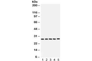 Western blot testing of 1) rat brain, 2) rat testis, 3) NEURO, 4) 293 and 5) SW620 lysate with SF2 antibody. (SRSF1 antibody)
