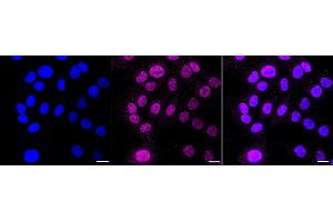 Immunocytochemical staining of HT- cells with Cullin 1 antibody (ABIN7798176), 1:1,000). (Recombinant Cullin 1 antibody)