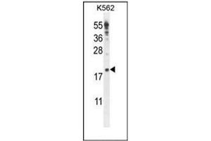 Western blot analysis of IQCJ Antibody (C-term) in K562 cell line lysates (35ug/lane). (IQCJ antibody  (C-Term))