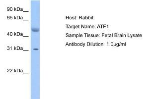 Host: Rabbit Target Name: ATF1 Sample Type: Fetal Brain lysates Antibody Dilution: 1. (AFT1 antibody  (N-Term))