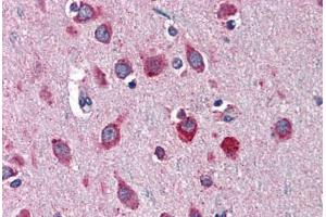 Human Brain, Cortex: Formalin-Fixed, Paraffin-Embedded (FFPE) (Neuroserpin antibody  (AA 17-411))