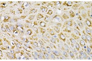 Immunohistochemistry of paraffin-embedded Human esophagus using EFNA1 Polyclonal Antibody at dilution of 1:100 (40x lens). (Ephrin A1 antibody)